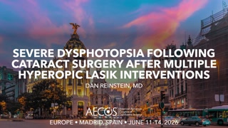 Severe Dysphotopsia Following Cataract Surgery after Multiple Hyperopic LASIK Interventions.mp4